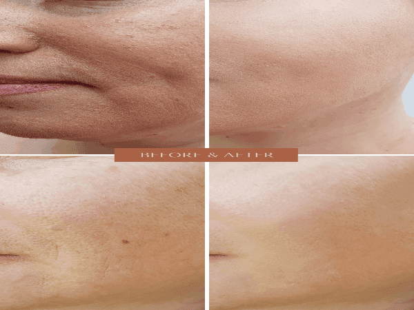 Organic Two-Step Anti-Aging Facial System - Wash and Moisturizer - For WOMEN